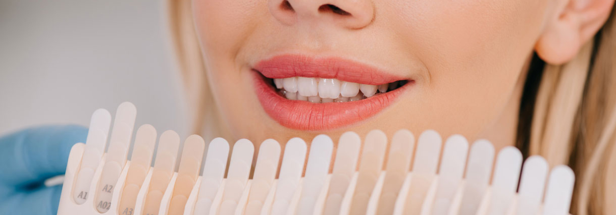 Teeth Whitening - All You Need to Know