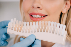 Teeth Whitening - All You Need to Know